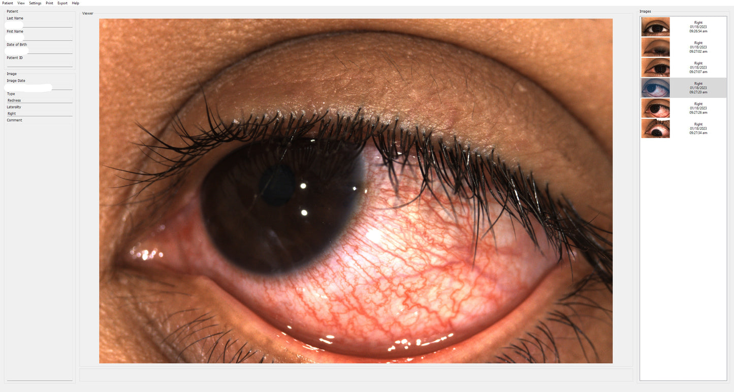 EyeCam 2.0