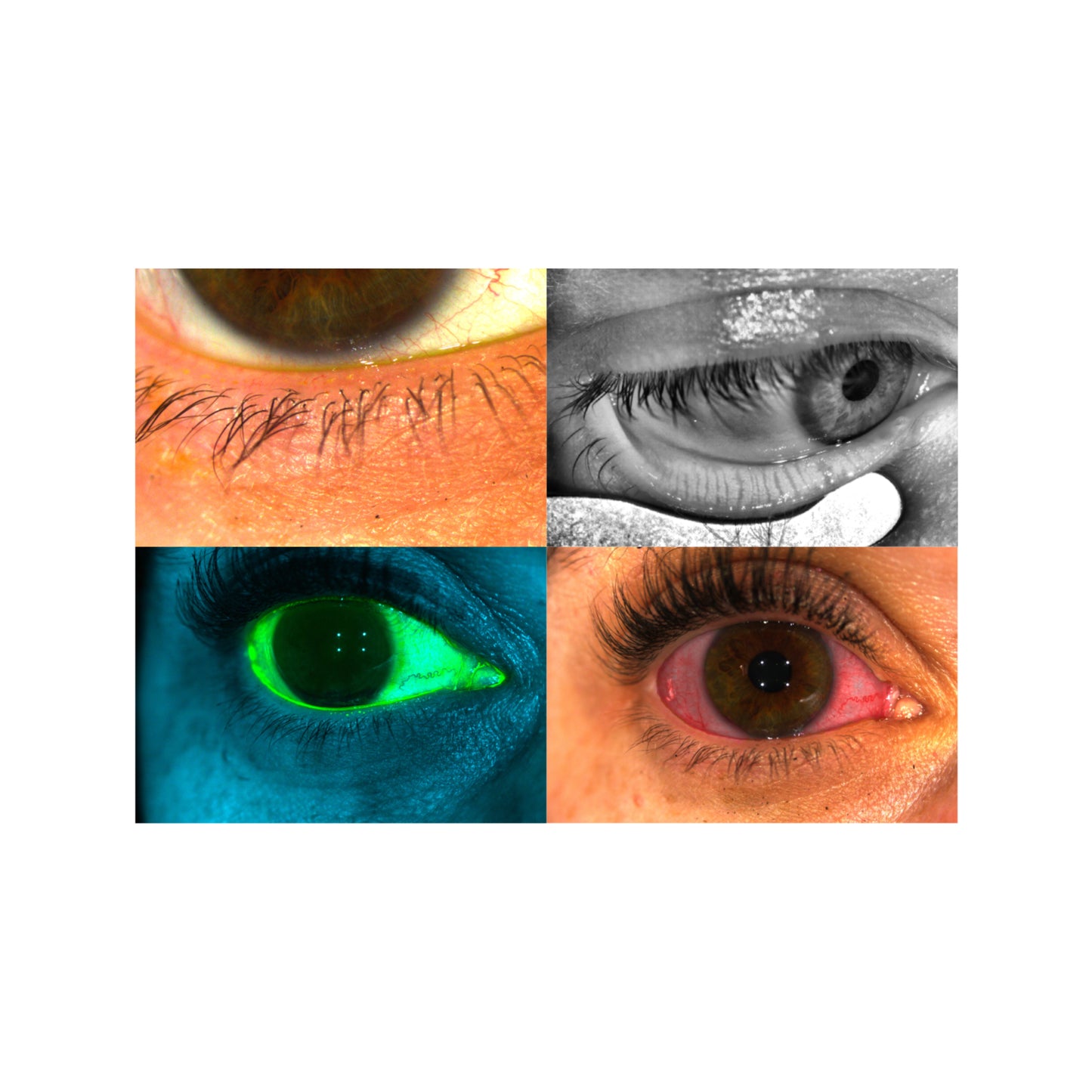 EyeCam 2.0